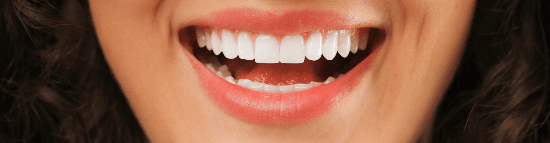 The Secret to a Lasting Smile: The Long-Term Health and Longevity of Porcelain Veneers