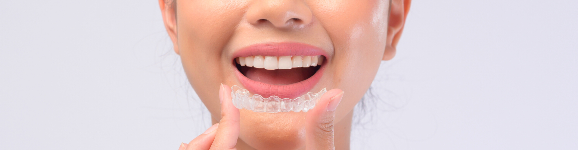 Invisalign in Bakersfield: Why Professionals in Northwest Bakersfield and Rosedale Are Straightening Their Smiles Without Braces