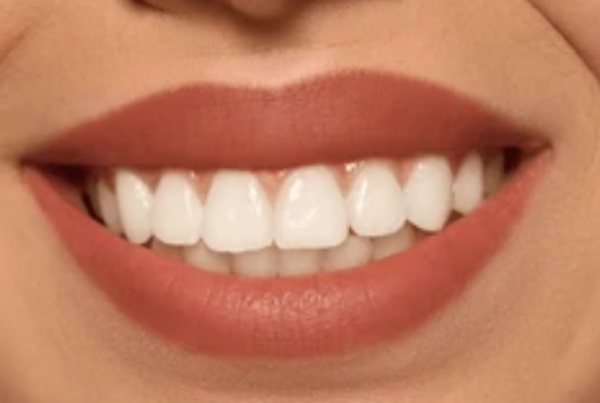 Close photo of woman's smile.