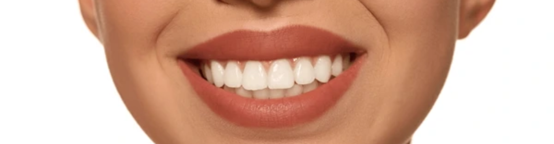 Teeth Whitening in Bakersfield: How Residents Near River Walk and Laurelglen Are Getting Brighter Smiles Before Summer