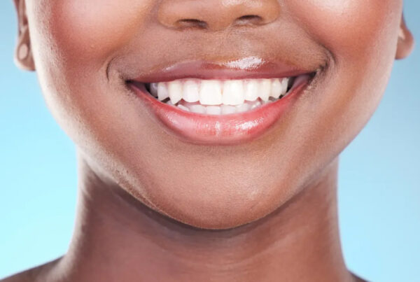 Photo of lower face of woman smiling.