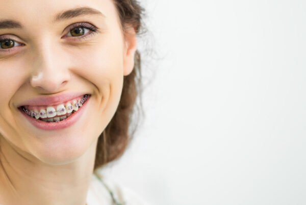 Smiing woman with braces.