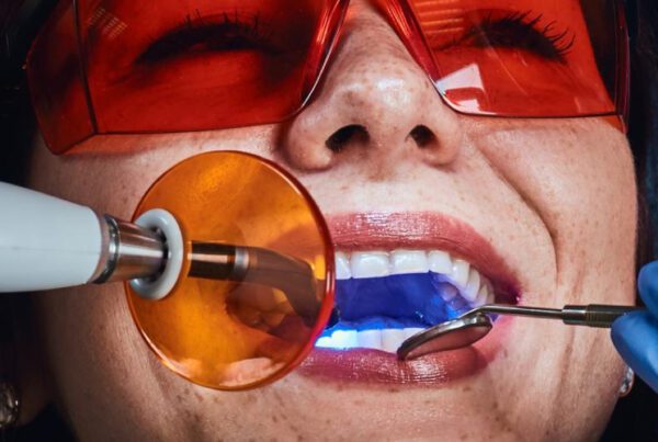 Patient undergoing professional teeth whitening with whitening gel activated by an LED curing light while wearing protective eyewear.